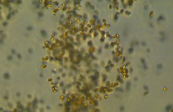 La alimentación mixotrófica del microbio Prorocentrum cf. balticum impacta en el ciclo del carbono y podría contribuir a combatir el cambio climático.