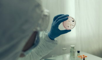 Científico examinando el virus en la placa de petri en un laboratorio.