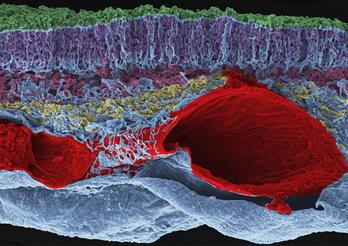 Retina de ballena , técnica de microscopia electrónica de barrido, coloreada a 400 aumentos.