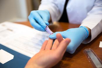 Test para detectar el VIH en la sangre.