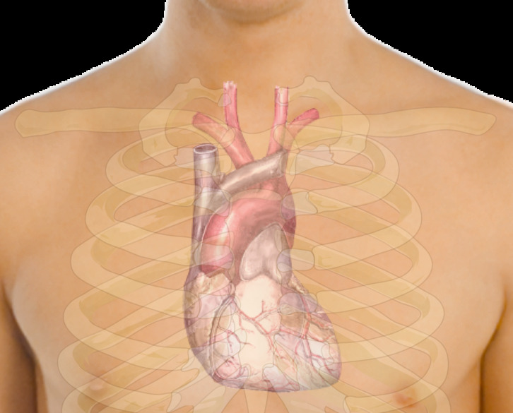 La fibrilación auricular es la clase más común de arritmia.