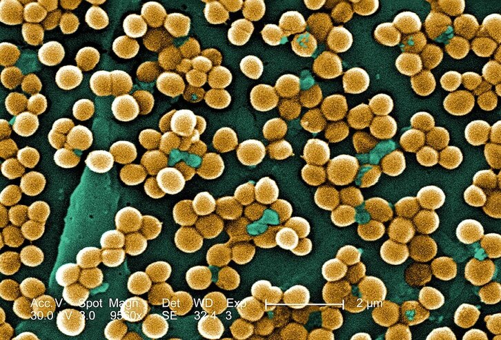 La bacteria Staphylococcus aureus.