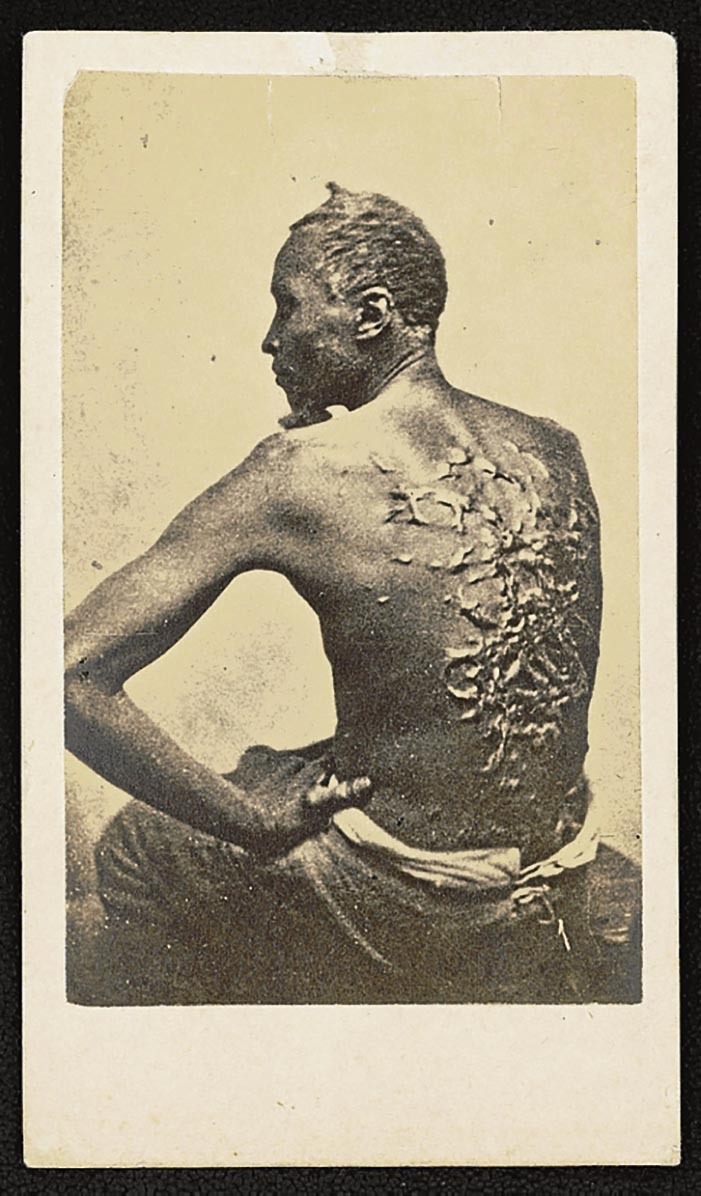 Ihes egin zuen Gordon esklaboa, hiru hilabete lehenago jasotako uhal-kolpeek utzitako zauriak mediku bati erakusten, Baton Rouge-n (Louisiana). Esklabotzaren basakeriaren ikur bilakatu da argazkia. Ron Harvey