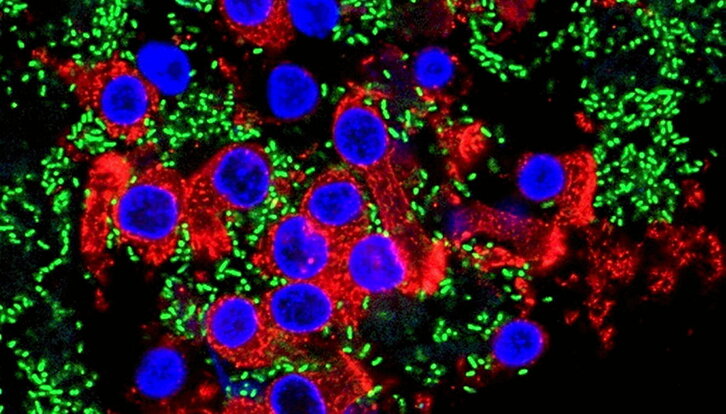 Infección de células pulmonares por la bacteria «Pseudomonas aeruginosa».
