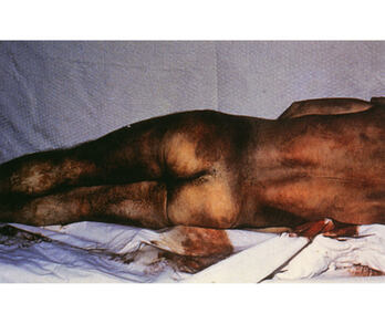 Irudiok oihartzun handia izan zuten, tortura zantzuak nabarmenak baitziren.