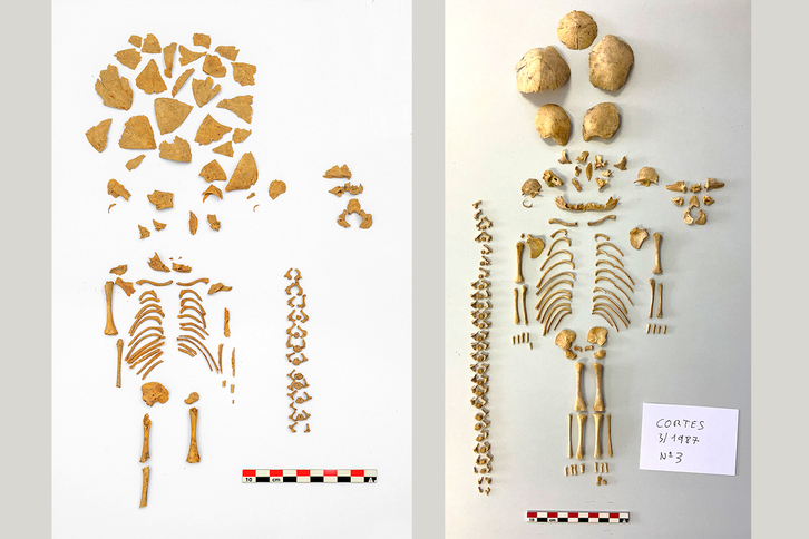 Esqueletos de un niño (izquierda) y una niña (derecha) hallados en Nafarroa con síndrome de Down.