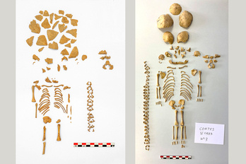 Esqueletos de un niño (izquierda) y una niña (derecha) con síndrome de Down.