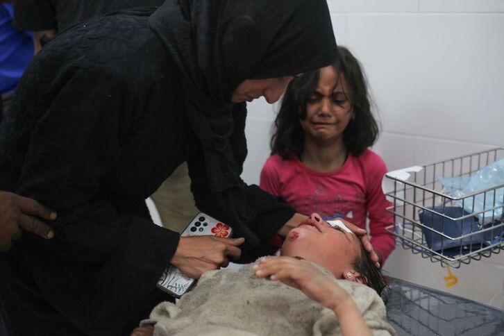 Israelen bonbardaketek zauritutako neskato gazte bat artatzen, Gazako ospitale batean. 