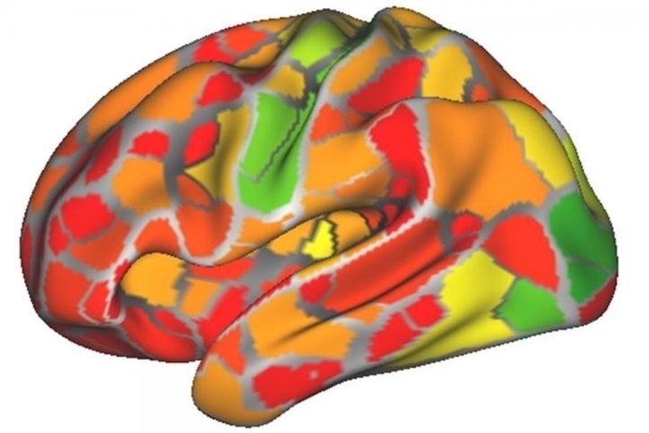 Los escáneres cerebrales pueden ayudar a diagnosticar trastornos neurológicos y psiquiátricos 