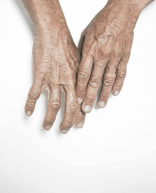 Atzamar okerrak dira osasun arazo honen ikurra.