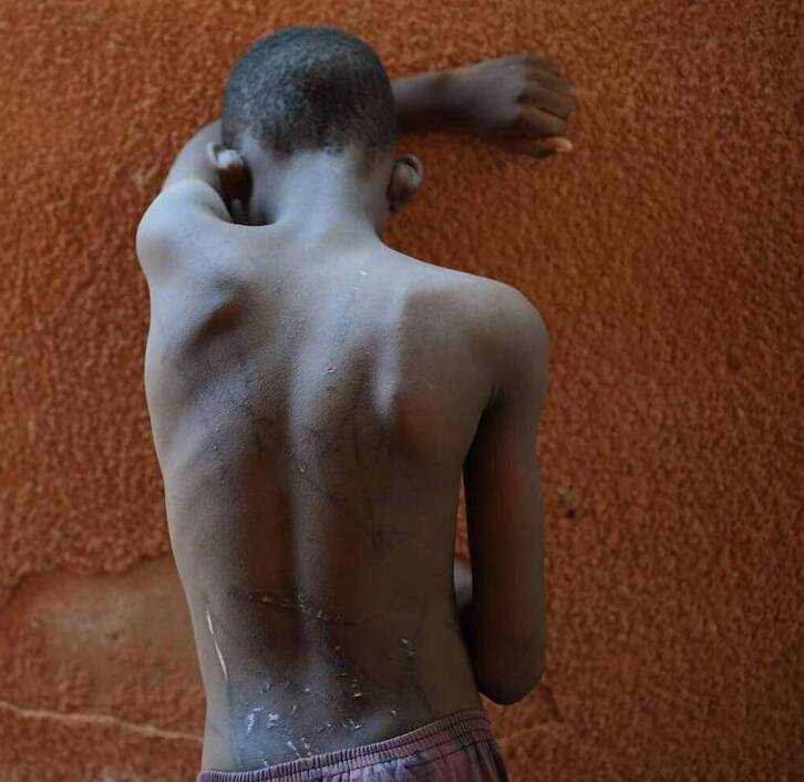 Las agresiones físicas afectan a 300 millones de niños muy pequeños en el mundo.