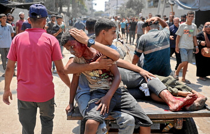 Palestinos heridos por el ataque israelí contra la escuela Khadija que albergaba a personas desplazadas en Deir al-Balah.