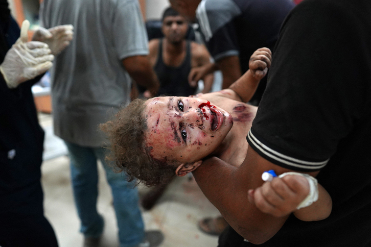  Un niño herido en un bombardeo israelí en Jan Yunis. Israel atacó ayer también Nuseirat y Rafah. 