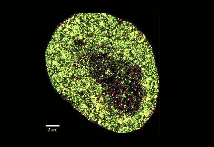 Imagen de altísima resolución de una célula cancerosa HeLa.