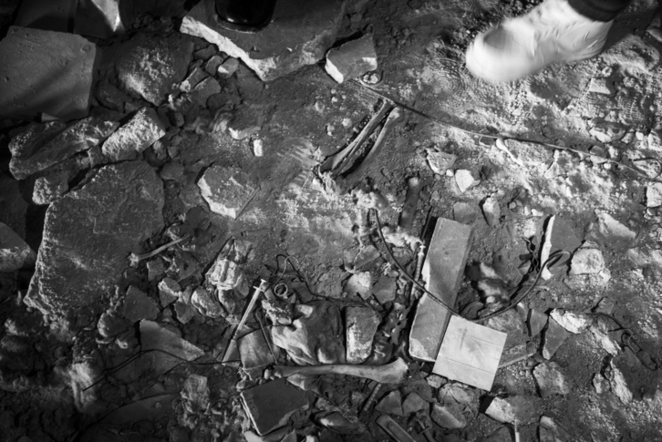 Alepoko ospitaleko hezurrak