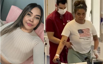 Karen Daniela Ágredo, en una foto antes de la agresión y durante los ejercicios de rehabilitación.