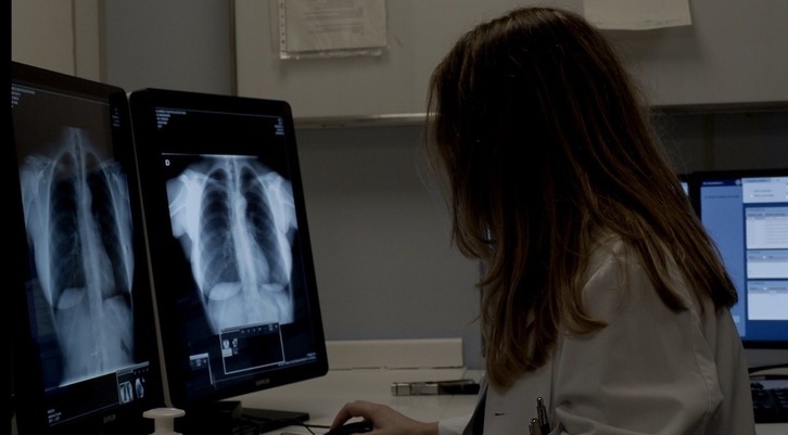 Una trabajadora de Osakidetza observa una radiografía.