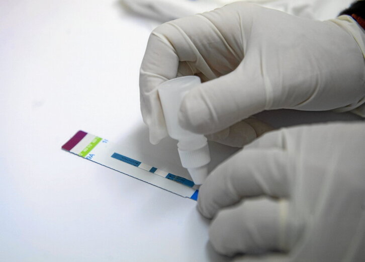 GIBaren proba azkar bat, artxiboko irudian.