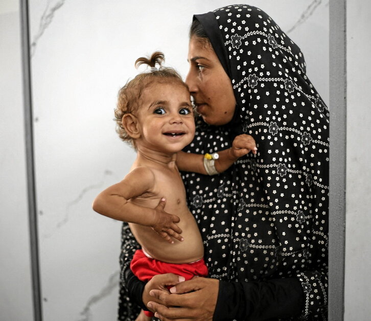 Una mujer palestina sostiene a una niña con malnutrición en el hospital Al-Awda.