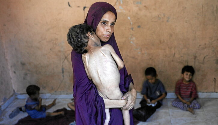 Naeema, una madre palestina de 30 años, carga a su desnutrido hijo Yazan, de 2 años, en el campo de refugiados de Al-Sahti.