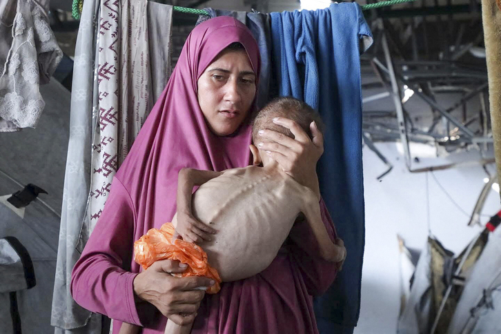 Una madre con su hijo en brazos y las terribles evidencias del hambre en Gaza.