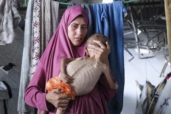 Una madre con su hijo en brazos y las terribles evidencias del hambre en Gaza.