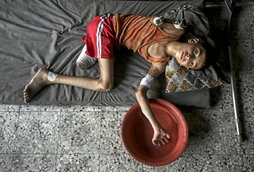 Samir Zaqout, de 11 años, descansa tras perder una pierna y un brazo en un ataque aéreo contra su casa en Ciudad de Gaza.