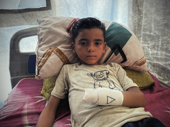 Muchos de los palestinos que han sufrido amputaciones son niños, como el de la imagen.