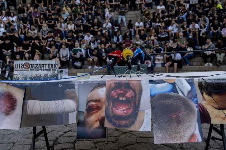 Imágenes de las heridas provocadas el 12 de octubre por la Ertzaintza en Gasteiz, en la convocatoria posterior de repulsa de cientos de personas.