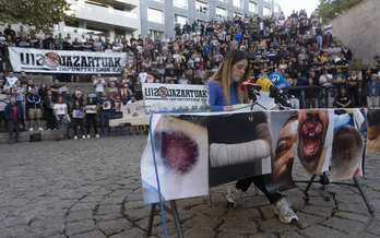 Imágenes de las heridas a Ibarra y otras víctimas, en la comparecencia posterior de denuncia.