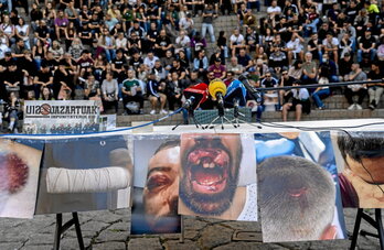 Denuncia de los heridos del 12 de octubre, en el centro la imagen de Aritz Ibarra tras recibir el balazo en la boca.