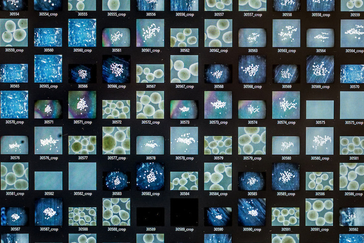 Investigación de cerebros humanos en un laboratorio suizo.