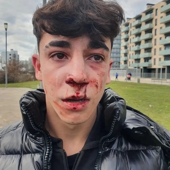 Así quedó el rostro del menor tras la agresión.
