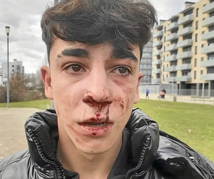 El rostro del menor tras la agresión.