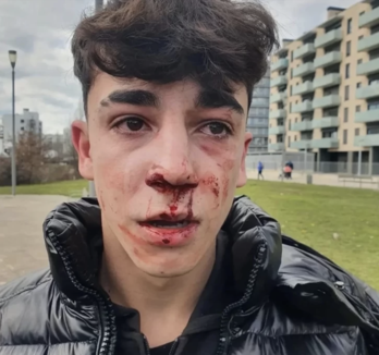 Rostro del menor tras la agresión