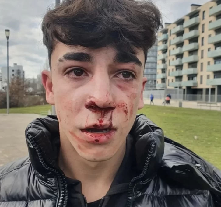 Rostro del menor tras la agresión