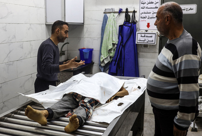 El cuerpo de la niña de 11 años Nidal Samir Hoso, en el hospital Al-Shifa.