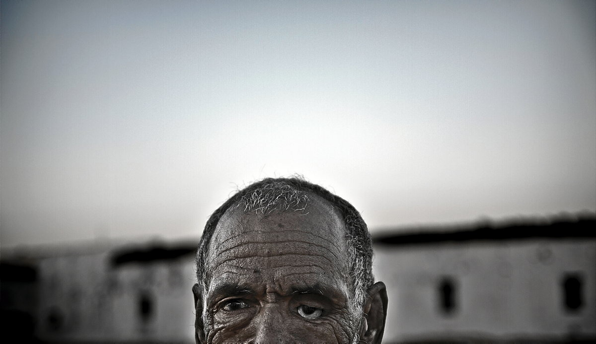 Un paciente del Hospital de Víctimas de Guerra muestra su ojo amputado durante una contienda contra el Ejército marroquí debido a una bala. (Andoni Lubaki | Ronak Press)