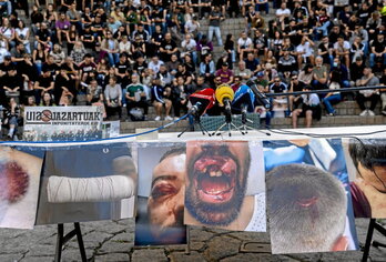 Denuncia de los antifascistas heridos por la Ertzaintza en las cargas del 12 de octubre protegiendo a la Falange.