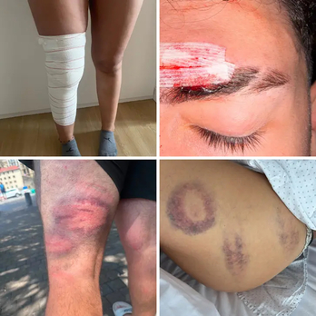 Imágenes de las heridas que sufrieron varias personas por la actuación policial.