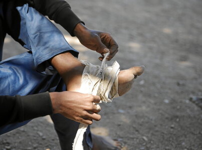 Uno de los migrantes que cruzó la frontera de Ceuta se venda con un trapo las heridas que se hizo en los pies para conseguir entrar territorio europeo.