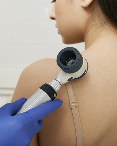 El diagnóstico precoz es una de las grandes armas para reducir la mortalidad de los melanomas. Osasunbidea y Osakidetza han desarrollado sistemas de teledermatología para agilizar el diagnístico.