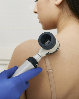 El diagnóstico precoz es una de las grandes armas para reducir la mortalidad de los melanomas. Osasunbidea y Osakidetza han desarrollado sistemas de teledermatología para agilizar el diagnístico.