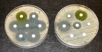 Test para detectar superbacterias en laboratorios.